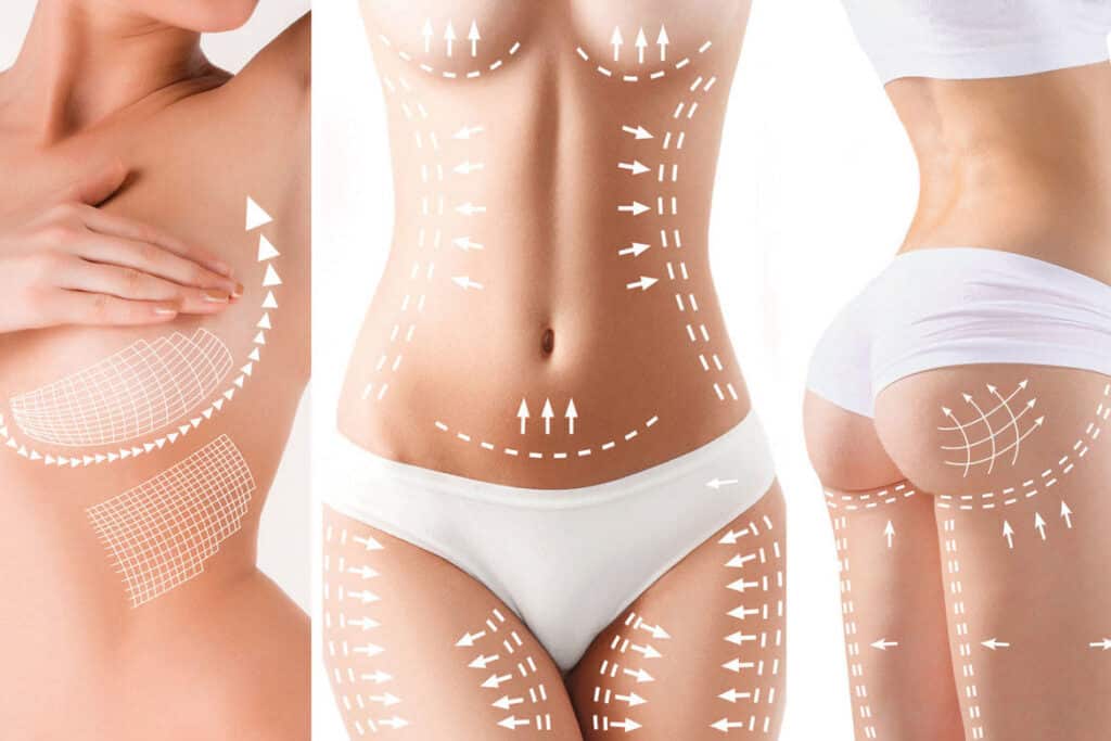 Ultimate Body Contouring Experience